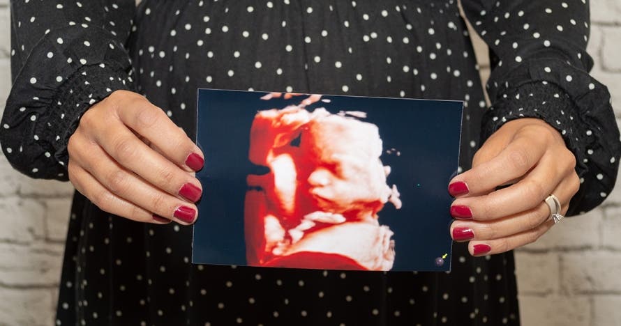 Conéctate con tu bebé: Ecografía Sensorial 5D