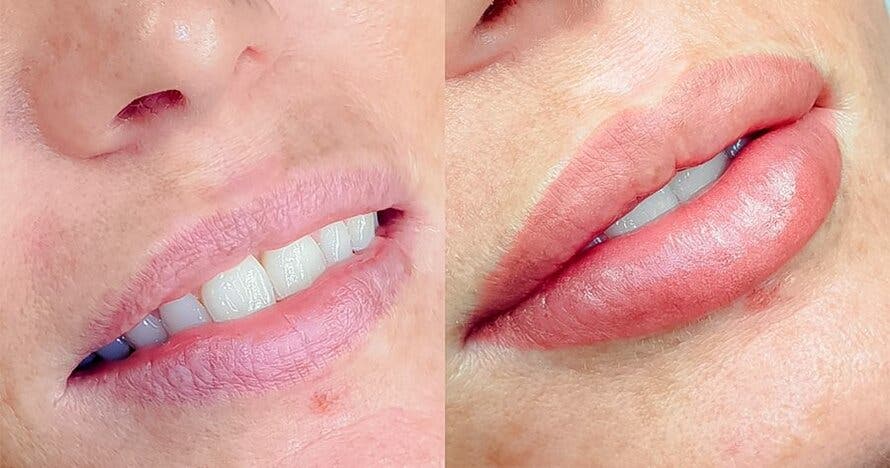 Labios perfectos y naturales con la micropigmentación semipermanente