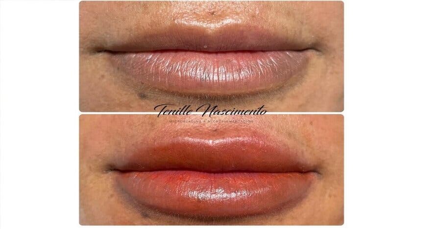 Micropigmentación labial: el secreto para una sonrisa irresistible