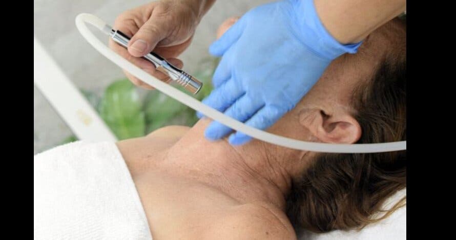 Tratamiento facial con Microdermoabrasión y Radiofrecuencia