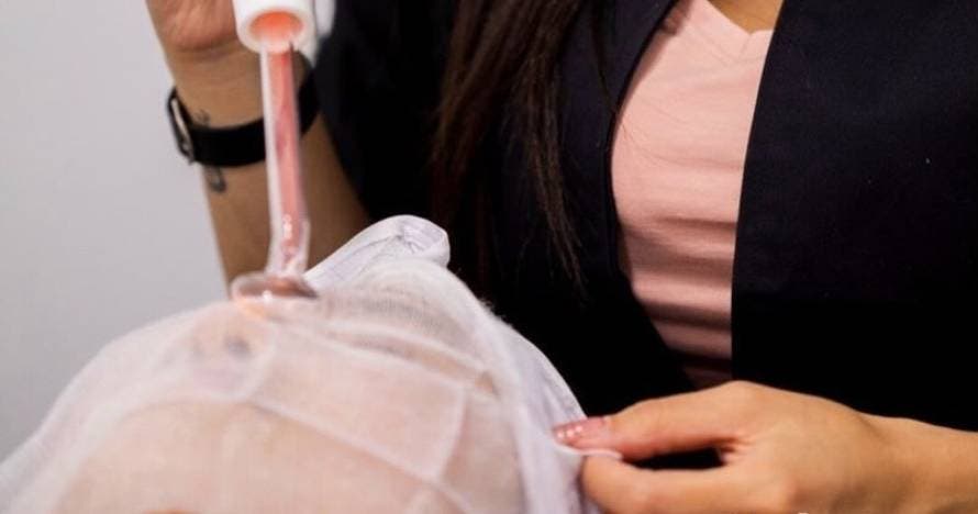 Limpieza facial con Derma Pen, borra las pequeñas imperfecciones