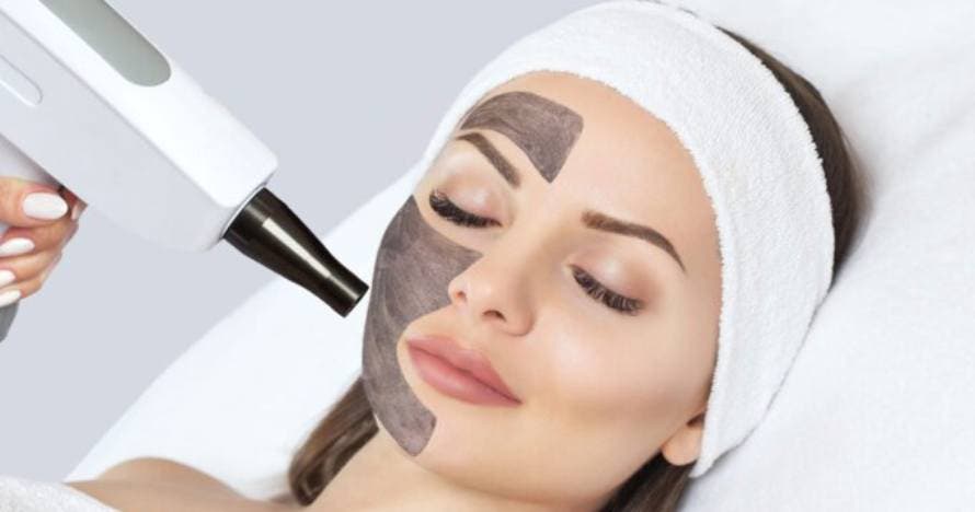 Renueva tu piel al instante con Carbon Peel láser