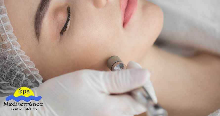 Limpieza profunda anti acné en rostro o espalda