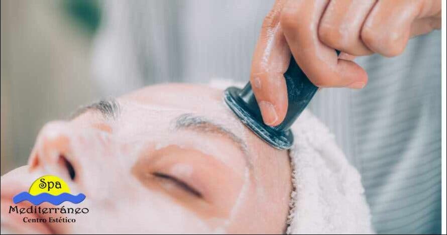 Facelift con radiofrecuencia INDIBA
