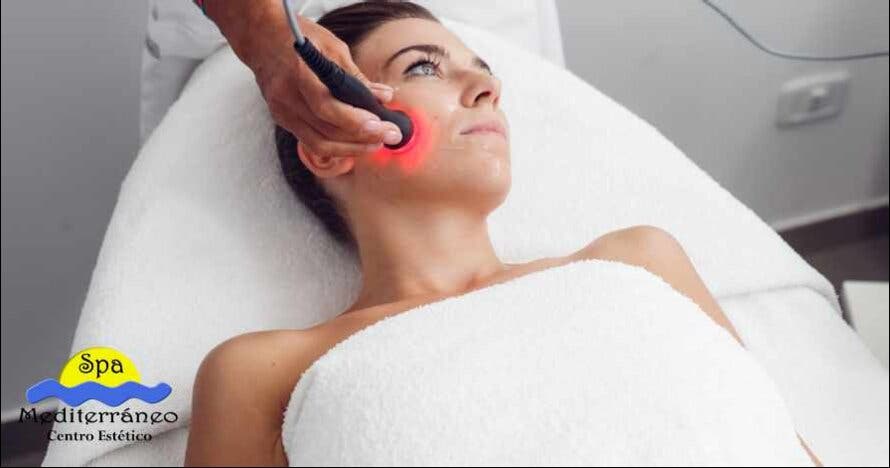 Facelift con radiofrecuencia INDIBA
