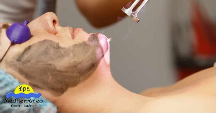 Hollywood peel