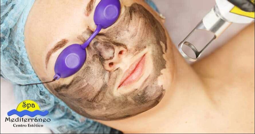 Hollywood peel