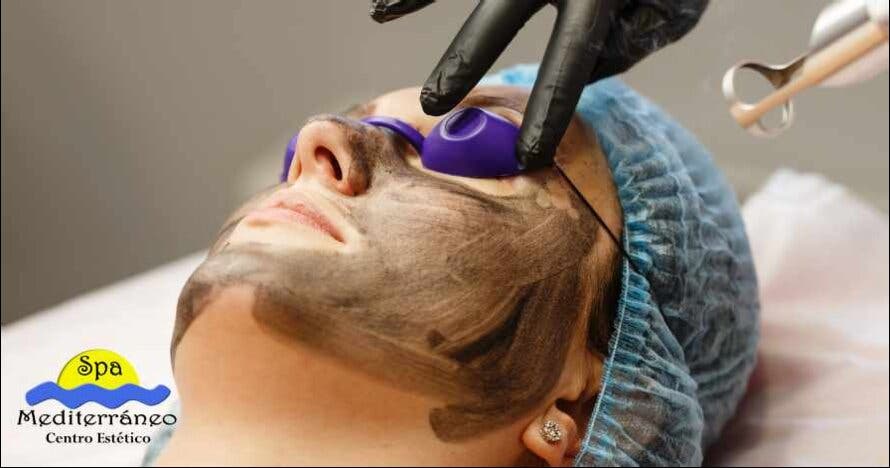 Hollywood peel