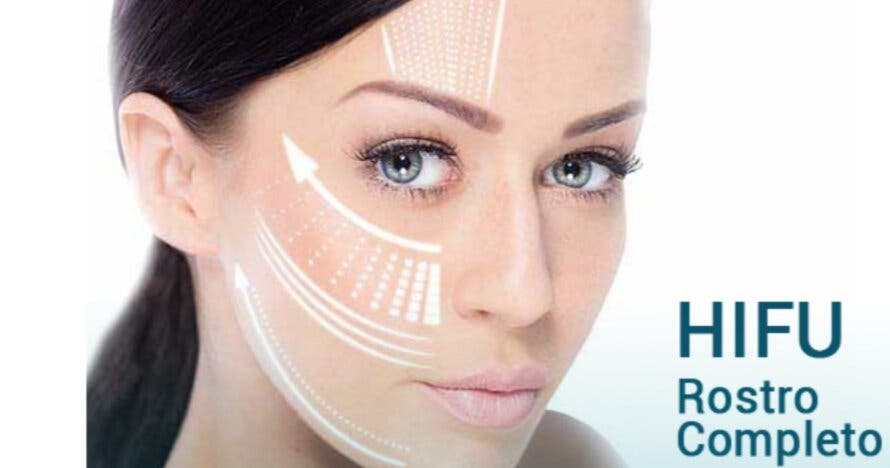 Ultralifting facial: rejuvenece tu rostro sin cirugía