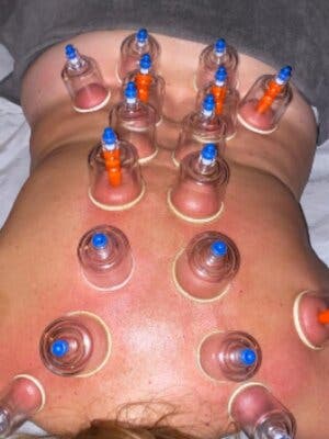 Descubre el secreto ancestral del masaje con ventosas en La Crme! foto 1