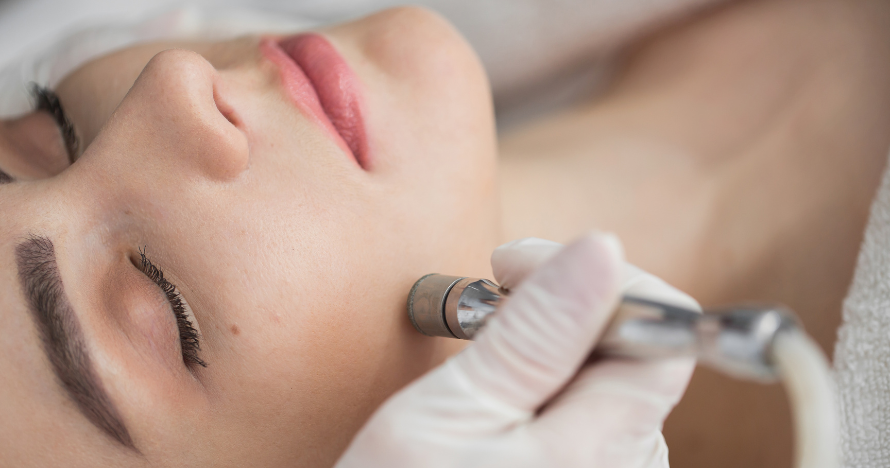 Tratamiento facial con Microdermoabrasión con punta de diamante