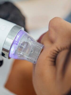 Tratamiento facial con Radiofrecuencia Médica Accent