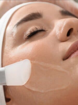 Tratamiento facial con Peeling Químico + Masaje facial