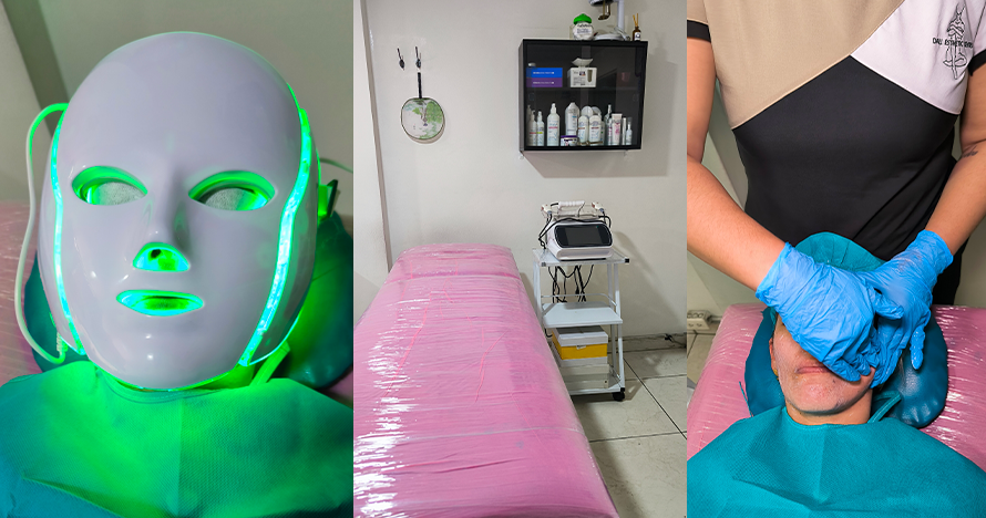 Rejuvenecimiento con Radiofrecuencia y Fototerapia (5 Citas)